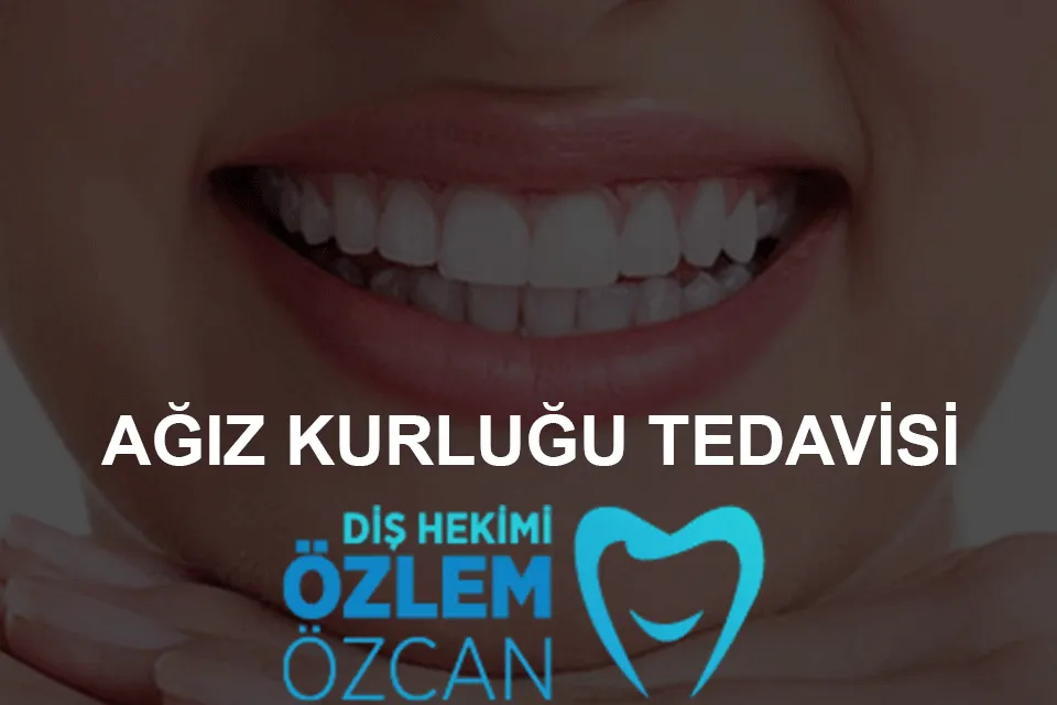 ağız kuruluğu tedavisi