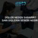 Dişler Neden Sararır? Sarı Dişlerin Sebebi Nedir? 2 dişler neden sararır