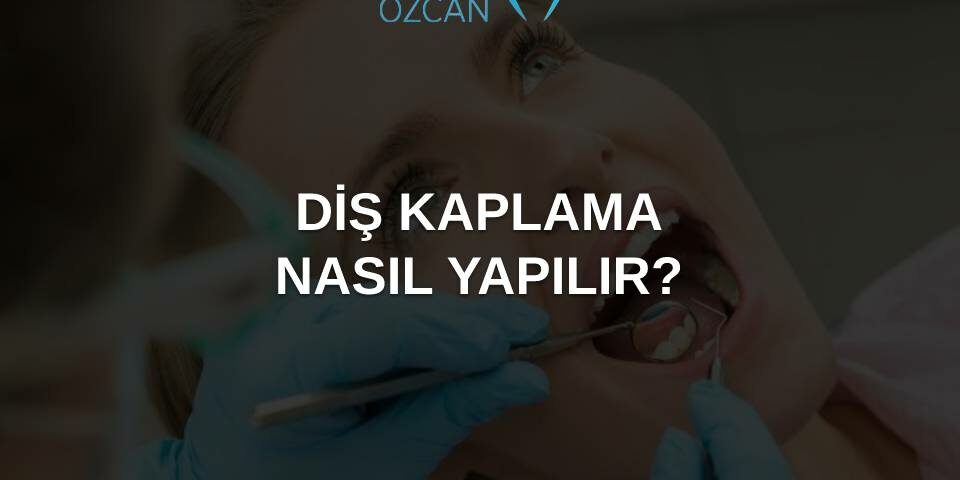 diş kaplama nasıl yapılır