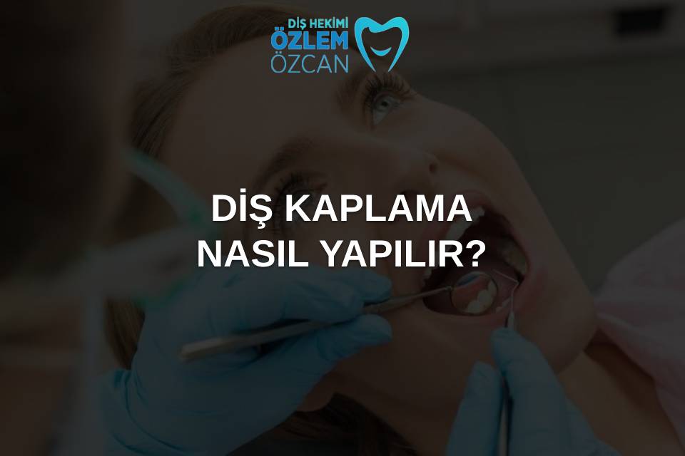 diş kaplama nasıl yapılır
