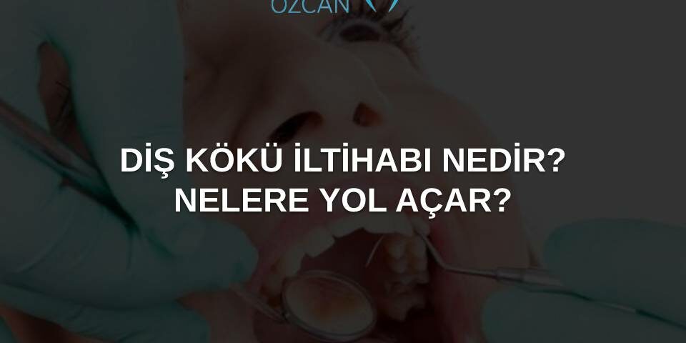 diş kökü iltihabı nedir