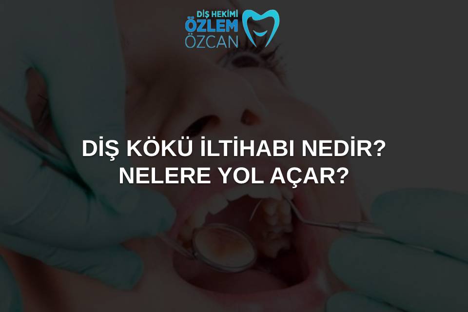 diş kökü iltihabı nedir