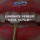 laminate veneer nasıl yapılır
