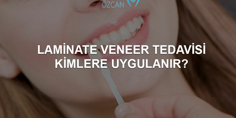 laminate veneer tedavisi kimlere uygulanır