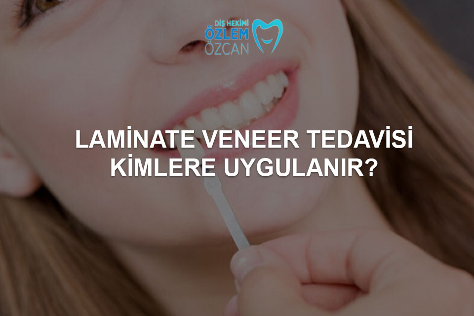 laminate veneer tedavisi kimlere uygulanır