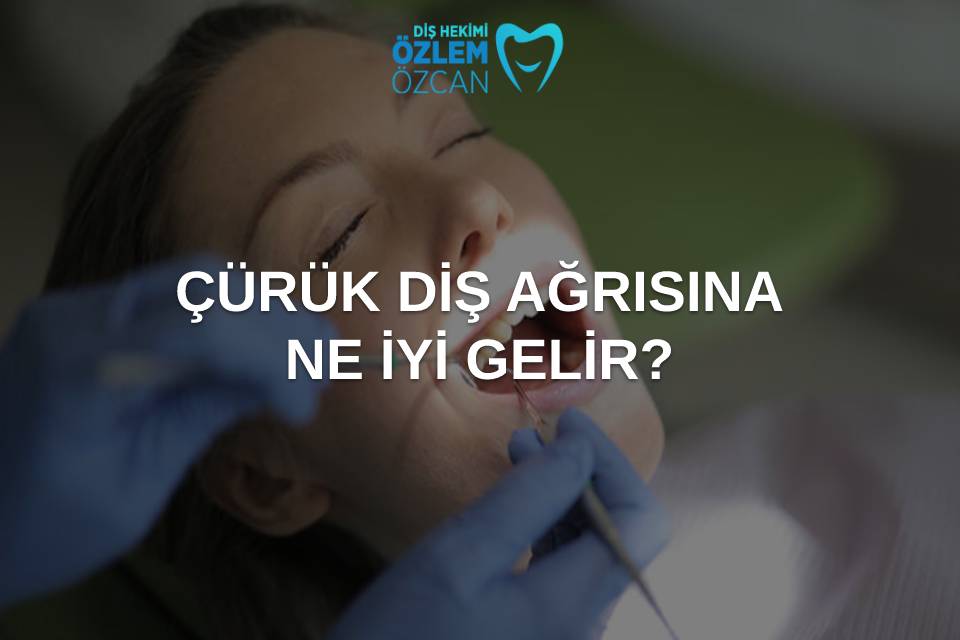çürük diş ağrısına ne iyi gelir