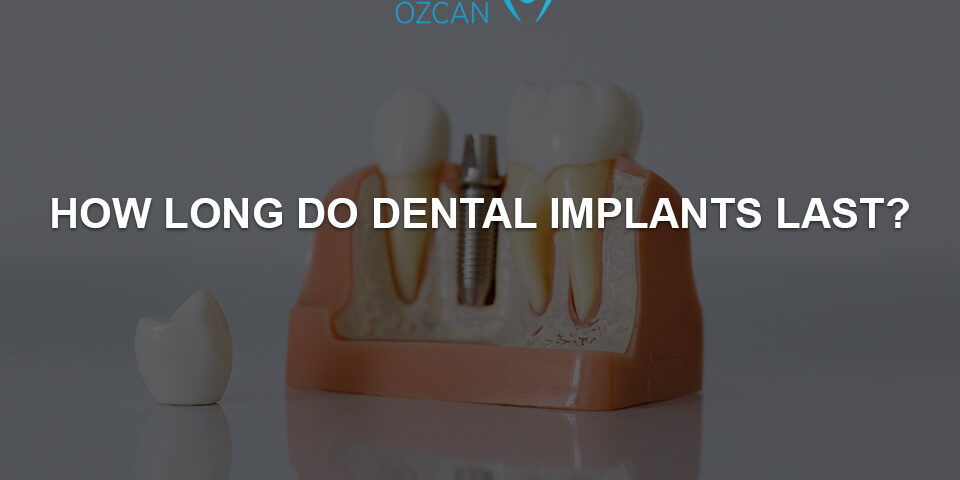 how long do dental implants last