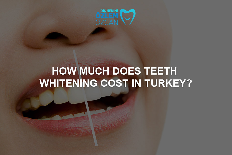 teeth whitening costs in turkey