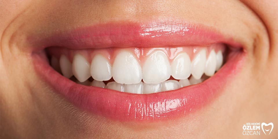 How Much Does Teeth Whitening Cost in Turkey? 5 teeth whitening cost turkey
