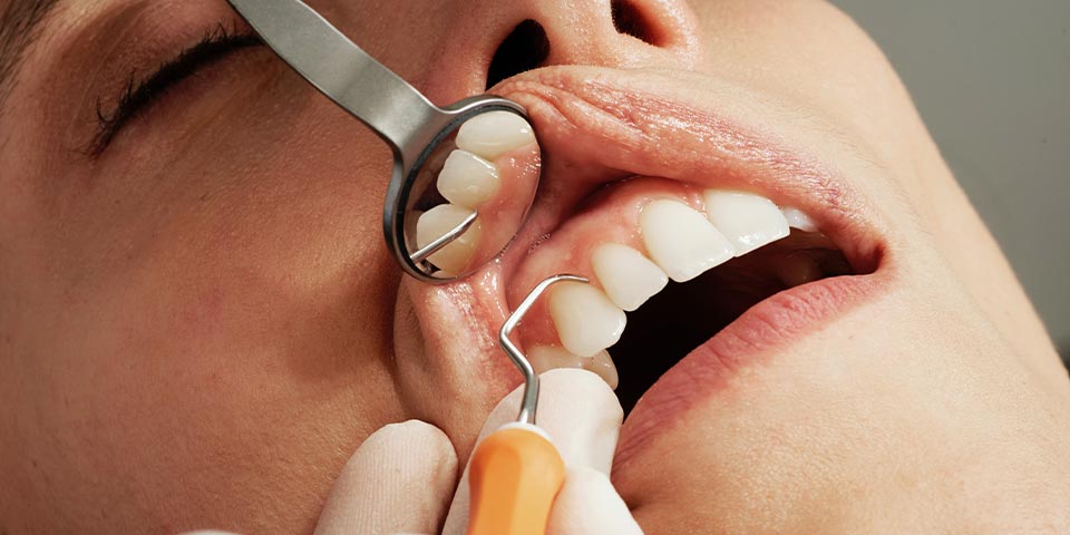dentists in turkey