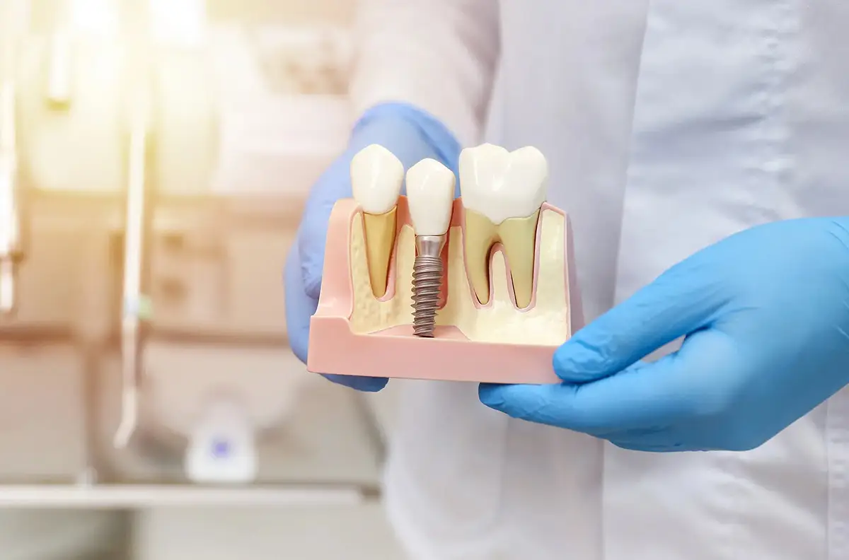 implant treatment istanbul turkey