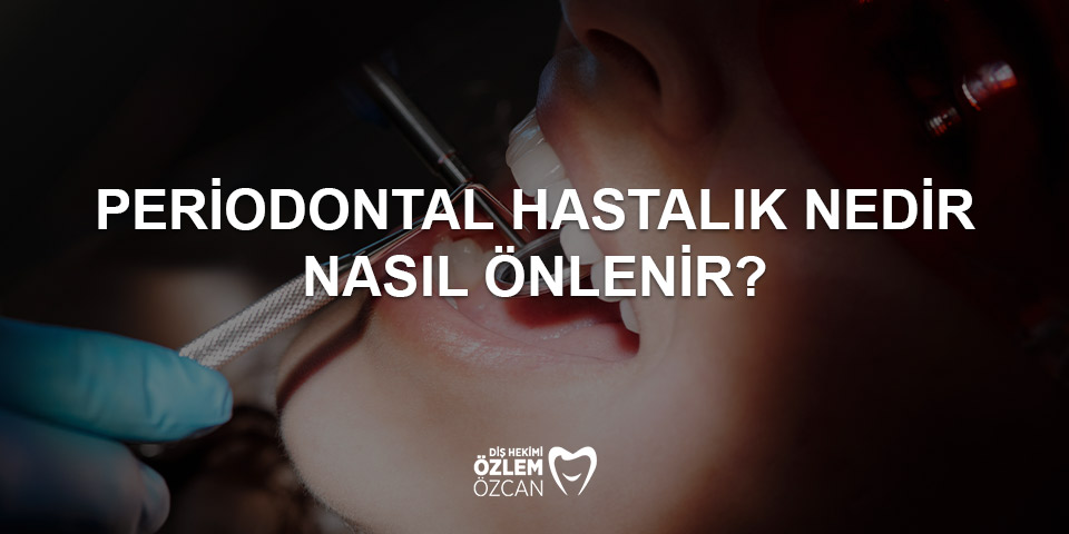 periodontal hastalık nedir