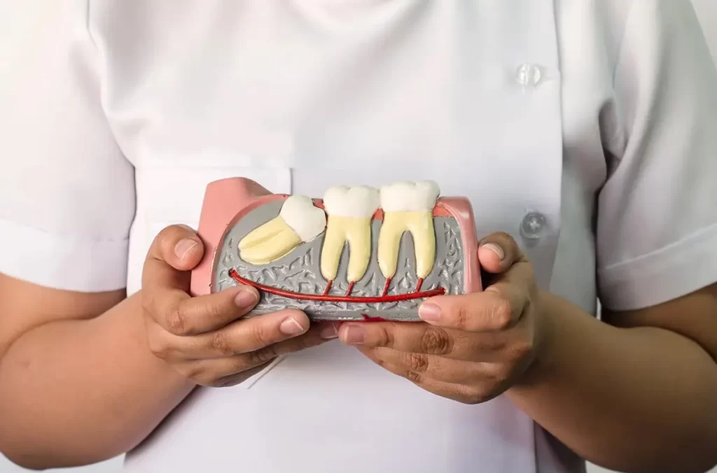 dentures turkey istanbul