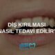 diş kırılması