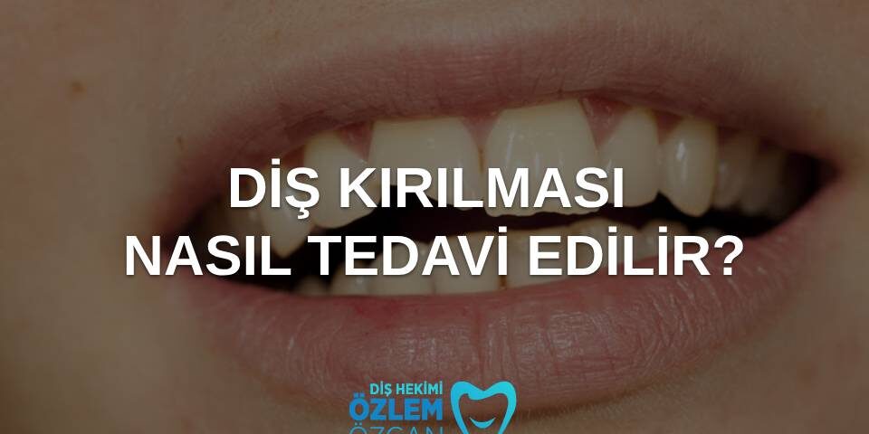 diş kırılması