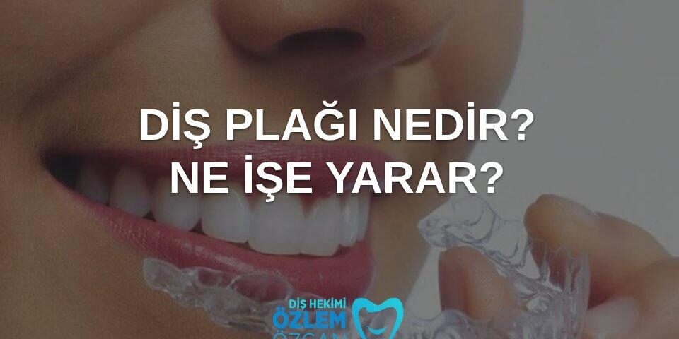diş plağı nedir