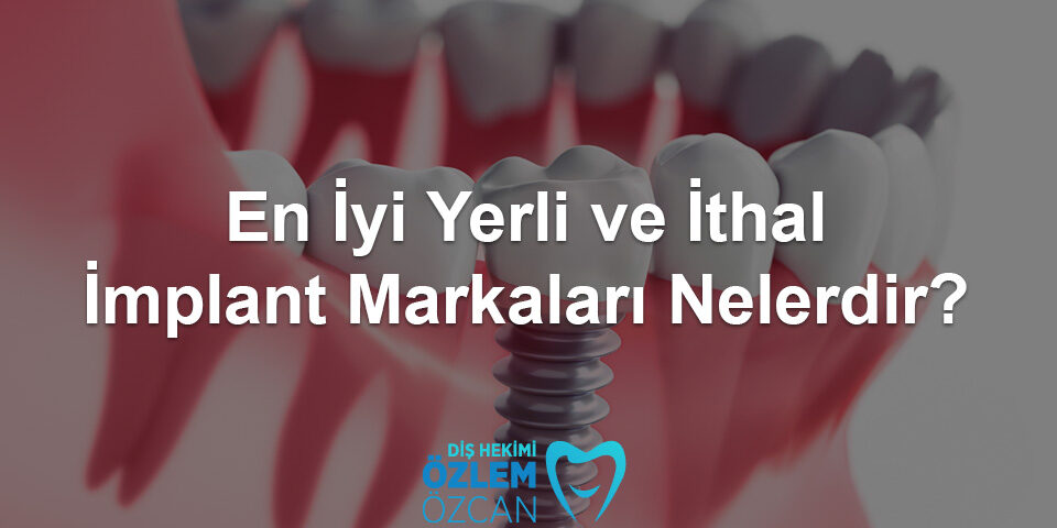 en iyi implant markaları