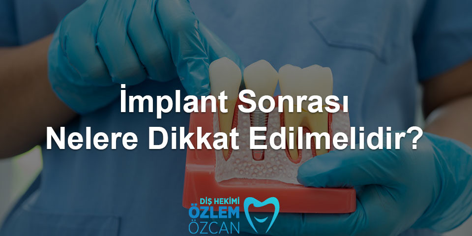 implant sonrası