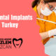 best dental implants in turkey