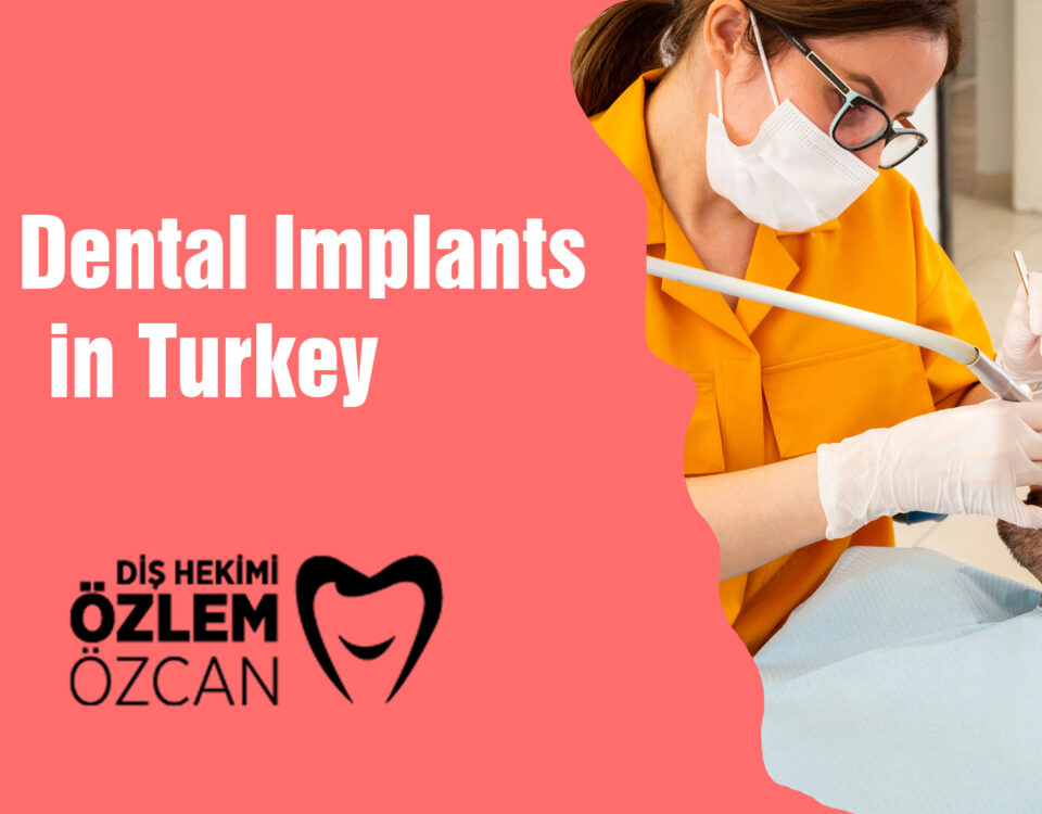 best dental implants in turkey