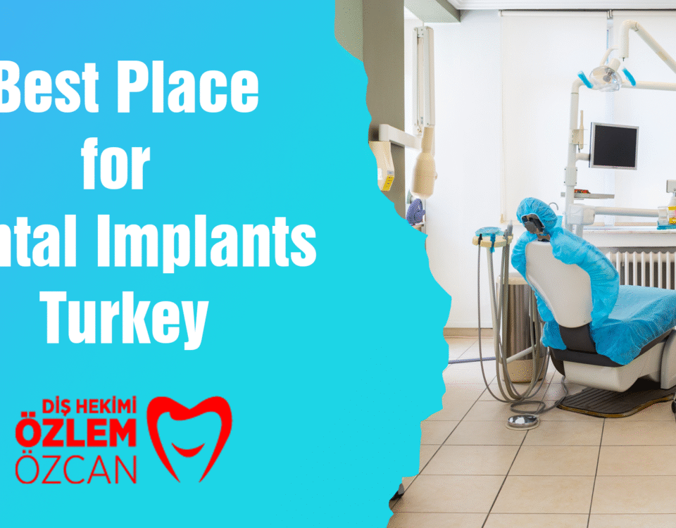 Best Place for Dental Implants Turkey