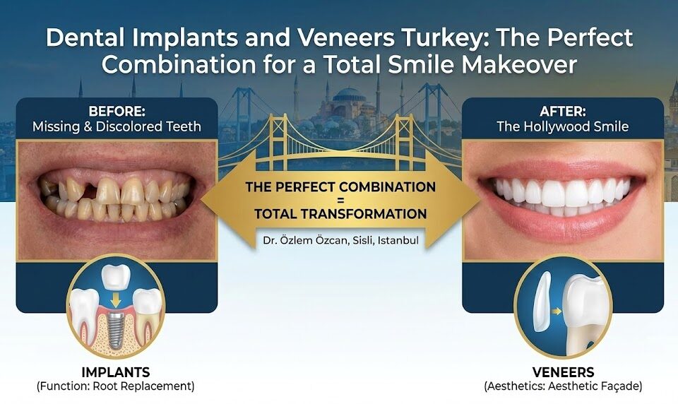 dental implants and veneers turkey