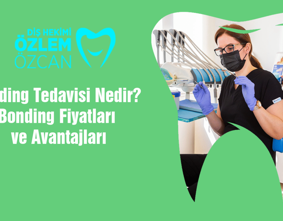 Bonding Tedavisi Nedir Bonding Fiyatları ve Avantajları