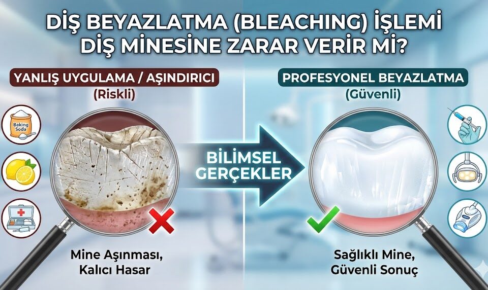 Diş Beyazlatma İşlemi Diş Minesine Zarar Verir mi