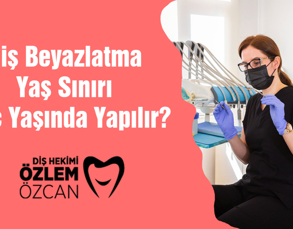 Diş Beyazlatma Yaş Sınırı Kaç Yaşında Yapılır