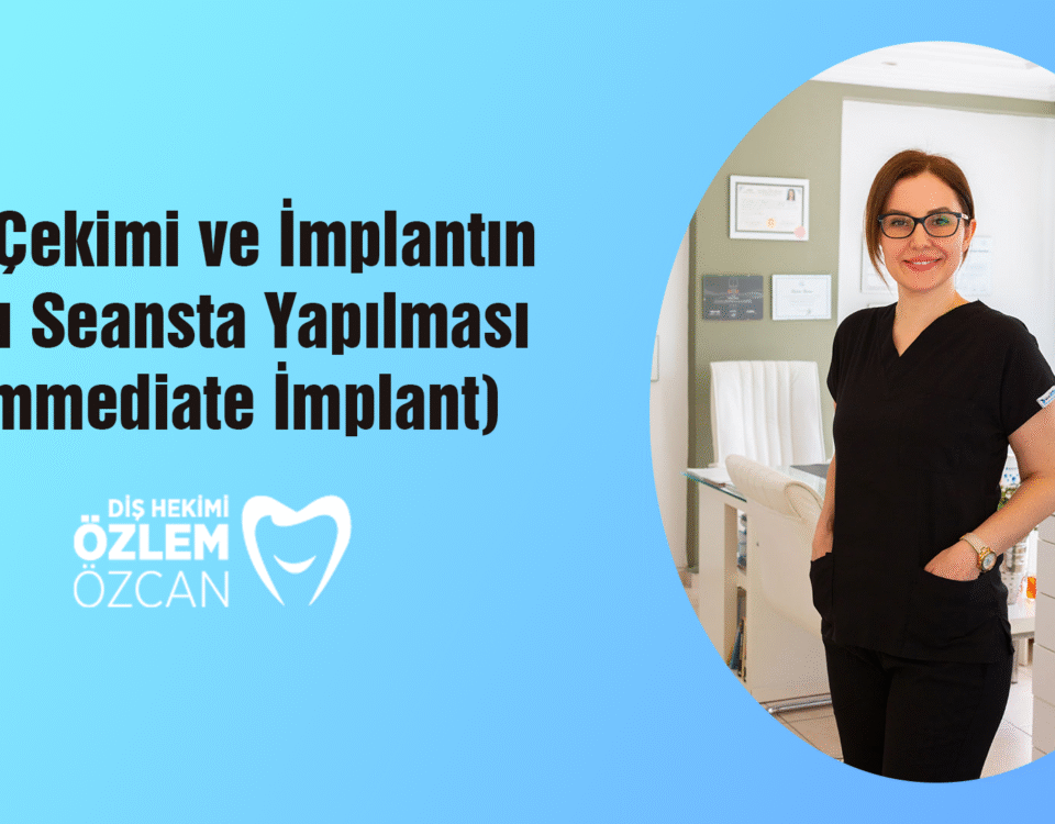 Diş Çekimi ve İmplantın Aynı Seansta Yapılması (Immediate İmplant)