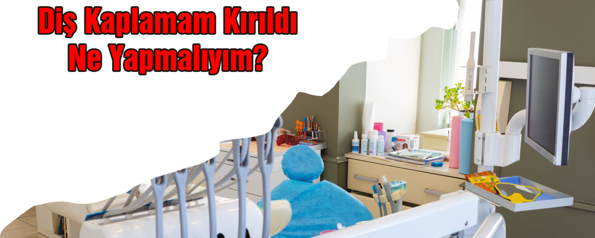 Diş Kaplamam Kırıldı