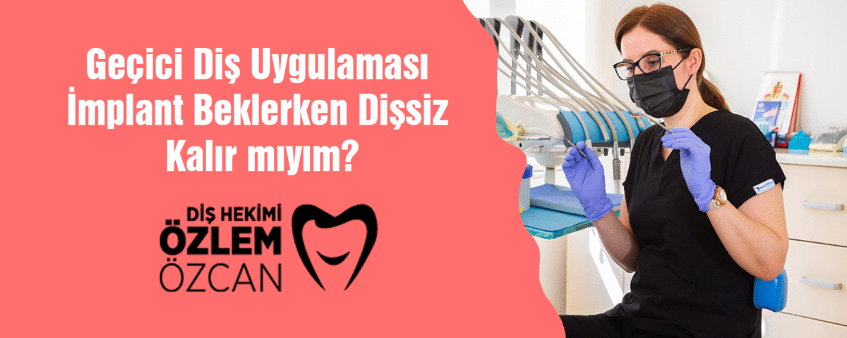 Geçici Diş Uygulaması İmplant Beklerken Dişsiz Kalır mıyım