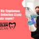 Geçici Diş Uygulaması İmplant Beklerken Dişsiz Kalır mıyım