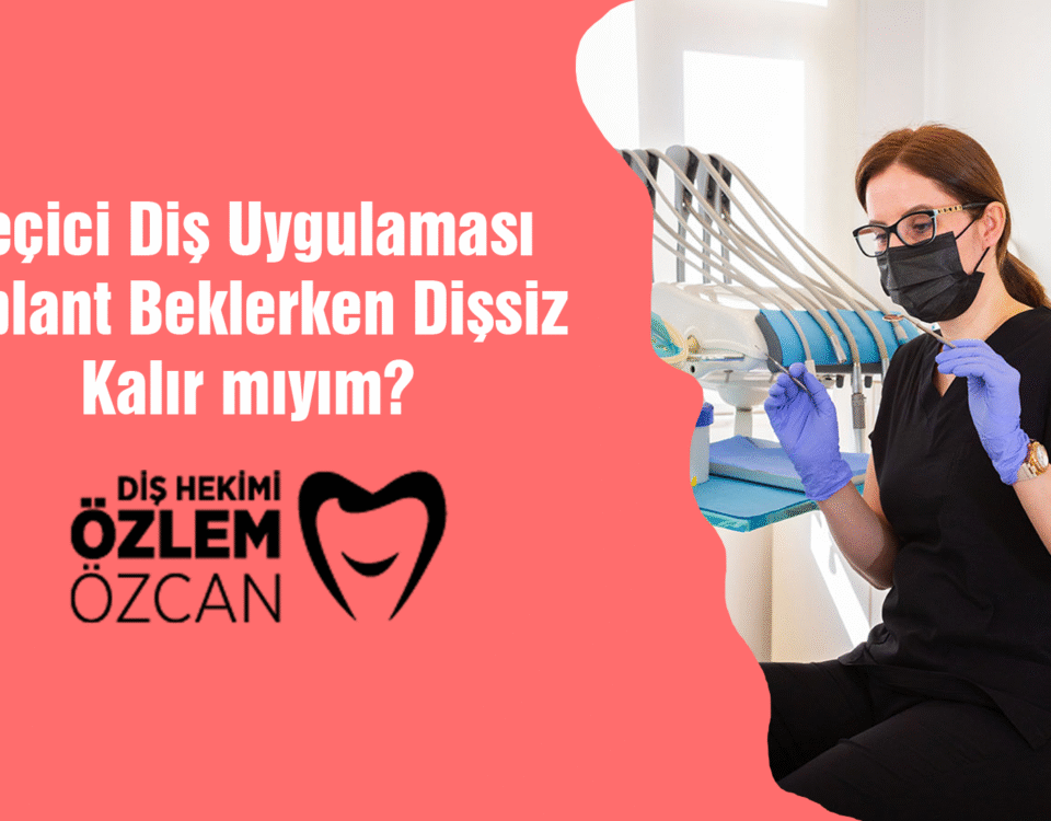 Geçici Diş Uygulaması İmplant Beklerken Dişsiz Kalır mıyım
