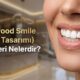 Hollywood Smile Gülüş Tasarımı Kriterleri Nelerdir