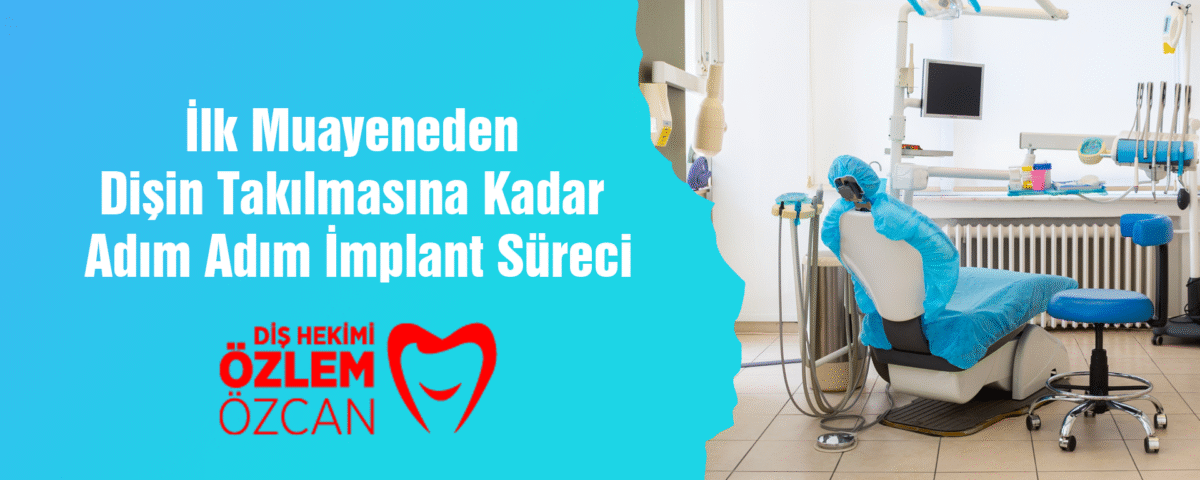 İlk Muayeneden Dişin Takılmasına Kadar Adım Adım İmplant Süreci