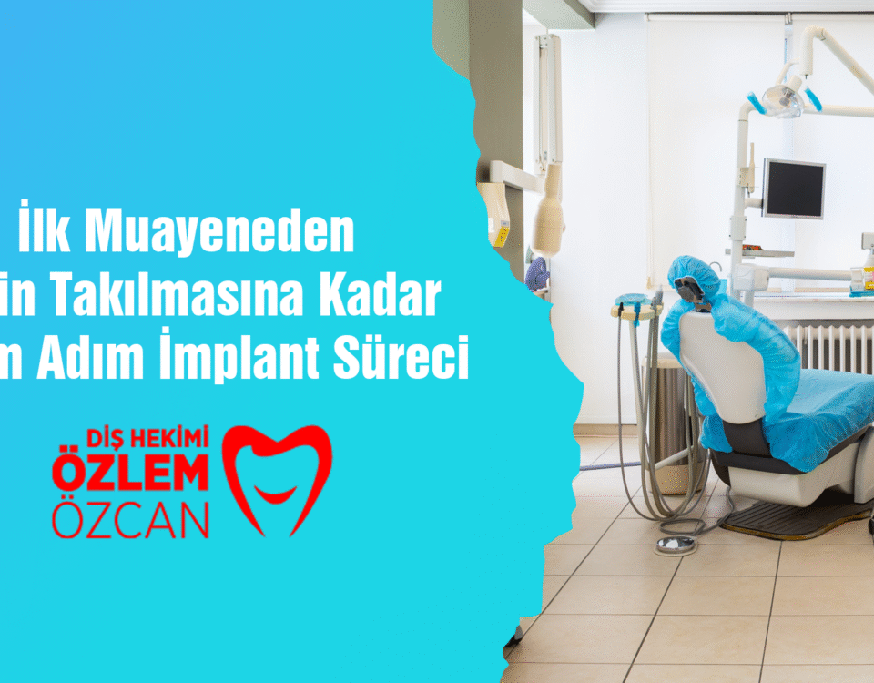 İlk Muayeneden Dişin Takılmasına Kadar Adım Adım İmplant Süreci