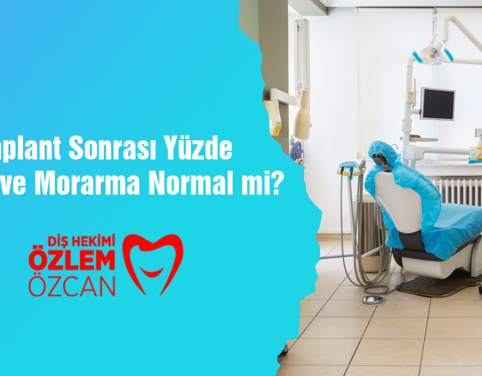 İmplant Sonrası Yüzde Şişlik ve Morarma Normal mi
