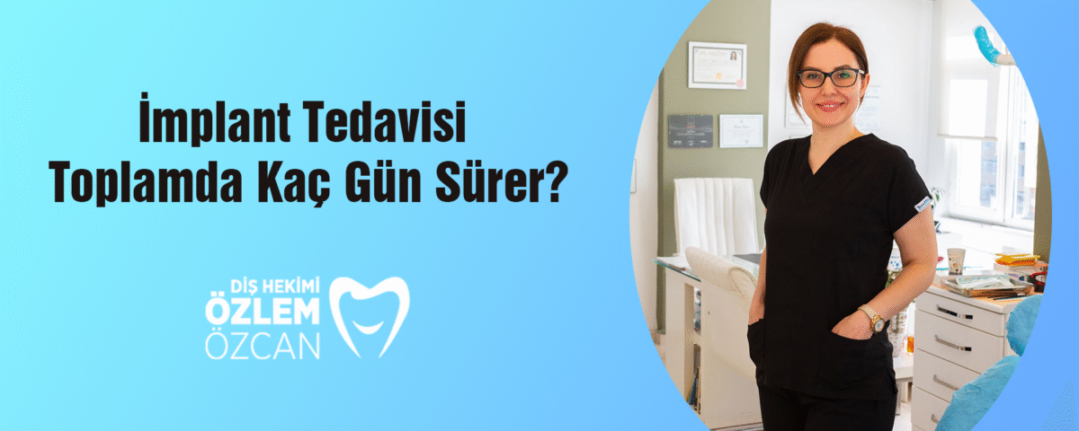 İmplant Tedavisi Toplamda Kaç Gün Sürer