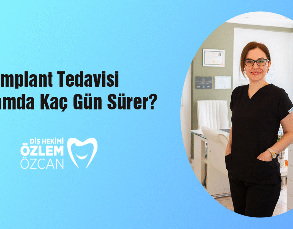 İmplant Tedavisi Toplamda Kaç Gün Sürer