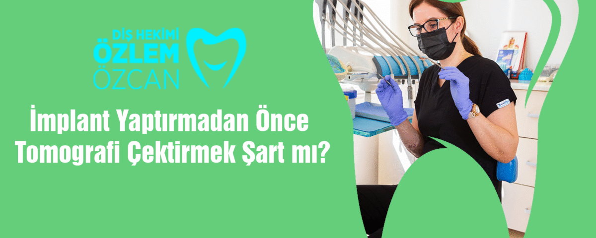 İmplant Yaptırmadan Önce Tomografi Çektirmek Şart mı