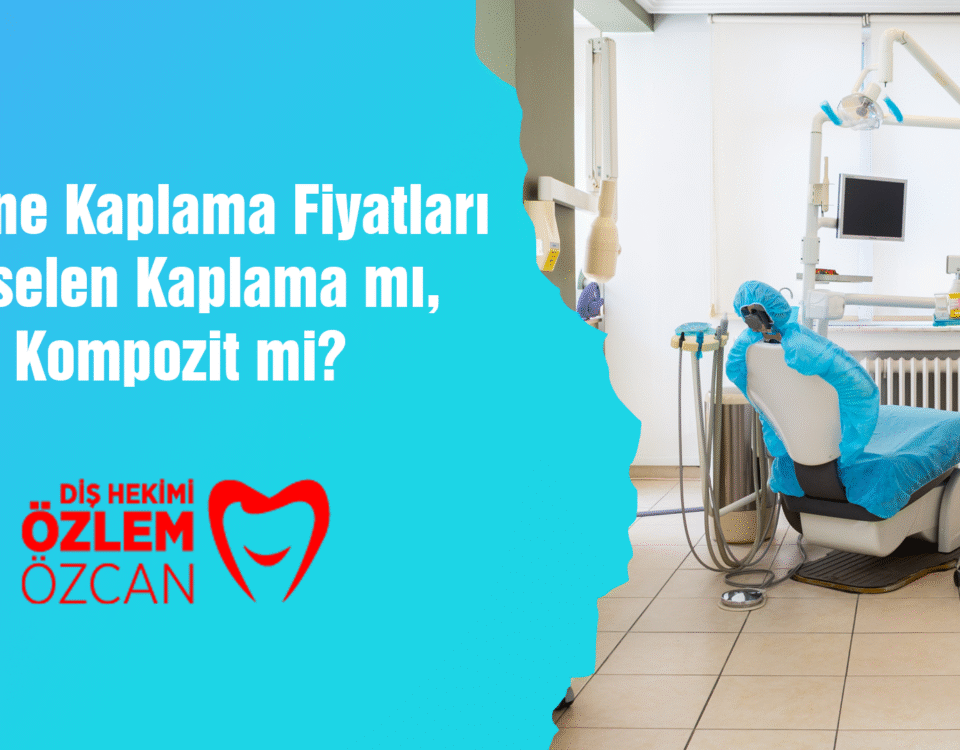 Lamine Kaplama Fiyatları Porselen Kaplama mı Kompozit mi