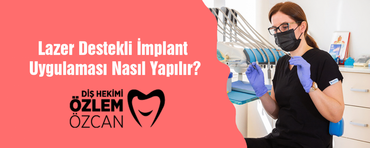 Lazer Destekli İmplant Uygulaması Nasıl Yapılır