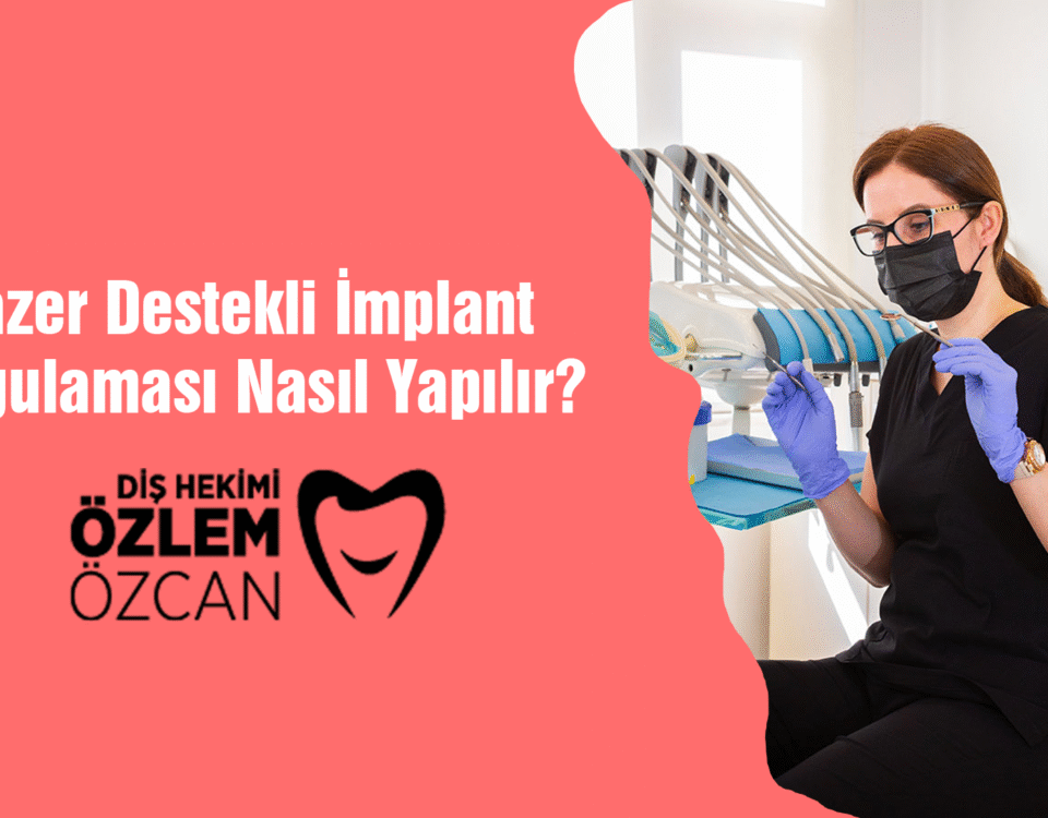 Lazer Destekli İmplant Uygulaması Nasıl Yapılır