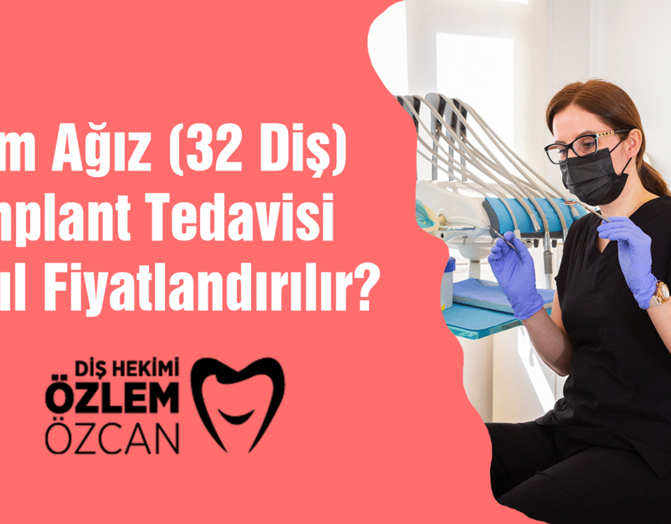 Tüm Ağız (32 Diş) İmplant Tedavisi Nasıl Fiyatlandırılır