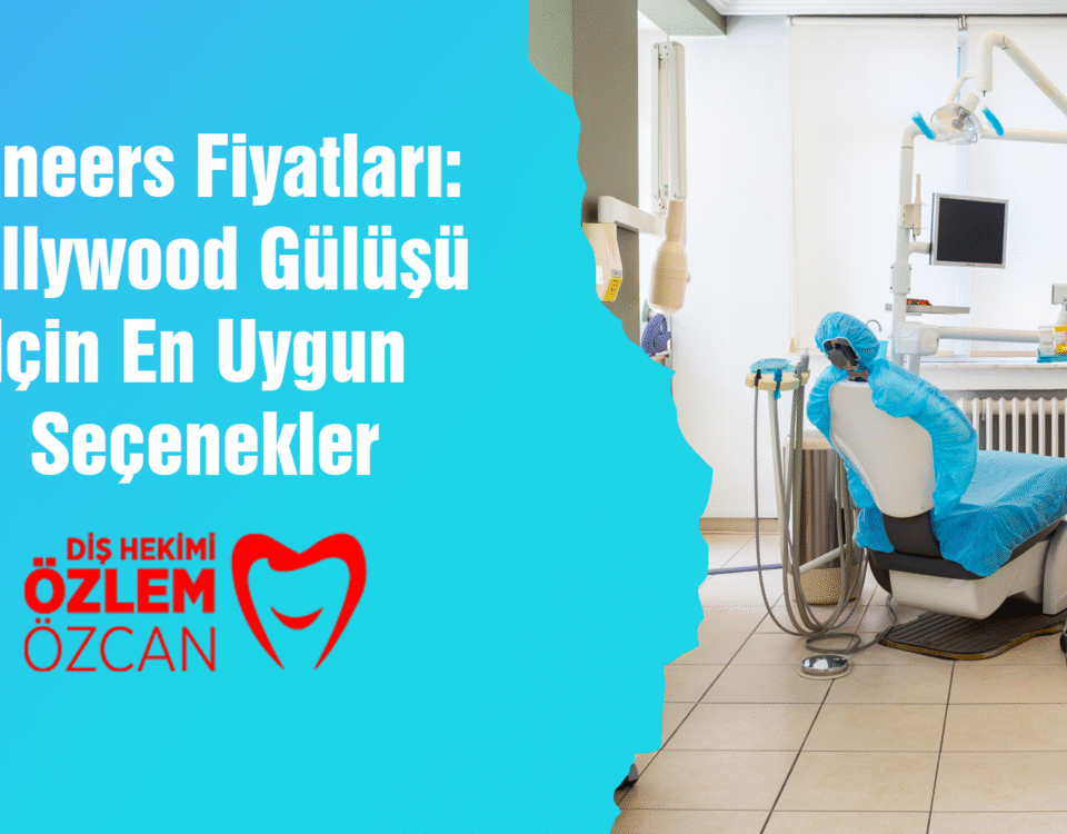 Veneers Fiyatları