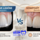 Yaprak Lamine (Veneer) ile Kompozit Lamine (Bonding) Farkı