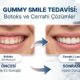 Gummy Smile (Diş Eti Gülüşü) Tedavisinde Botoks ve Cerrahi