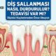 Diş Sallanması Nasıl Durdurulur