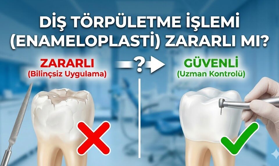 Diş Törpületme İşlemi (Enameloplasti) Zararlı mı